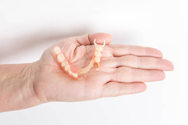 flexible nylon denture on a hand