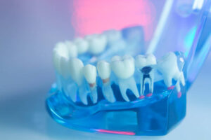 Dental teeth, mouth, gums dentists teaching model showing each tooth and roots.