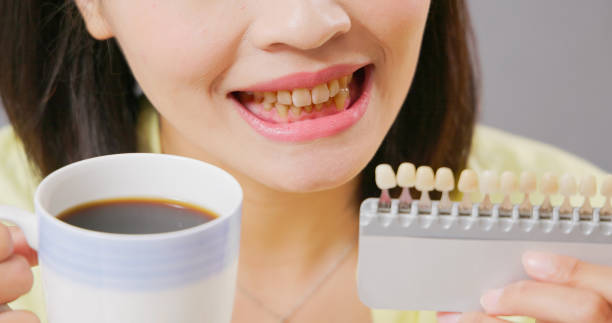 close up asian woman holding tooth color palette