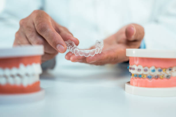 Orthodontist holding transparent dental aligners